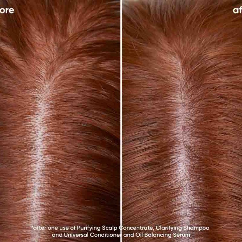 Biolage 2023 Scalp Sync Oily Before After Shannon Closeup 968x828