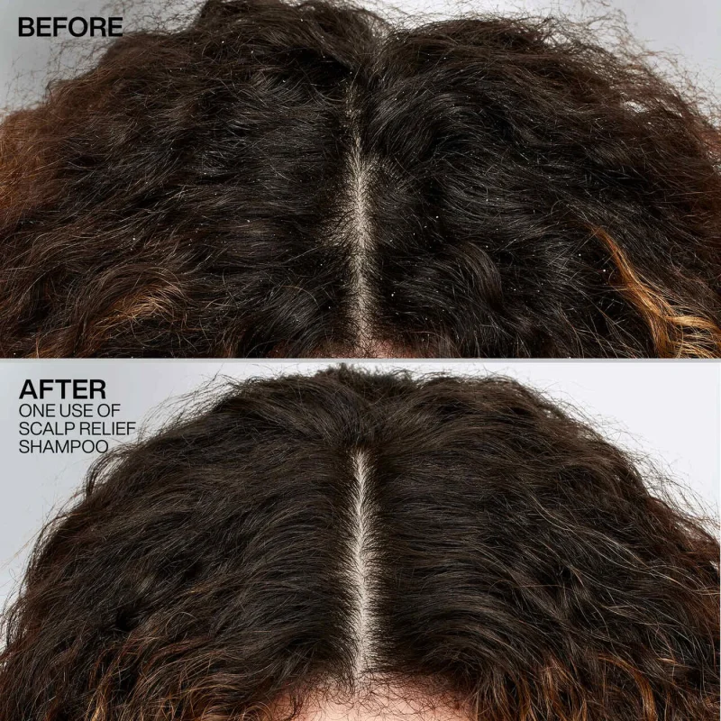 Scalp Relief Shampoo3